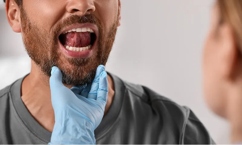 Treating and preventing mucositis